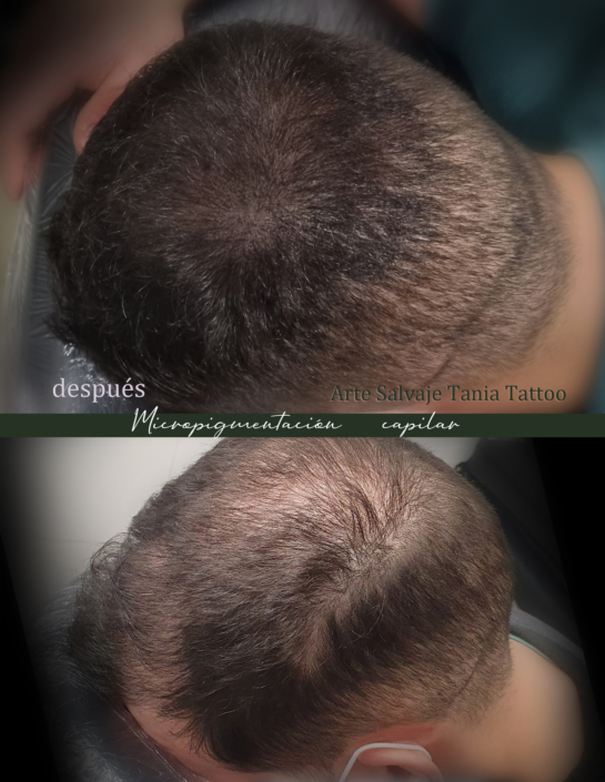 capilar micropigmentacion efecto densidad rapado en valencia tatuar pelo para hombres mujeres