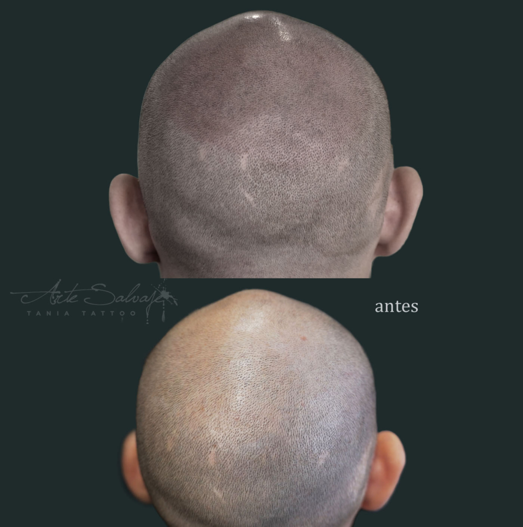 capilar en valencia tatuar pelo de micropigmentacion efecto rapado y densidad para hombre y mujer 3 (6)