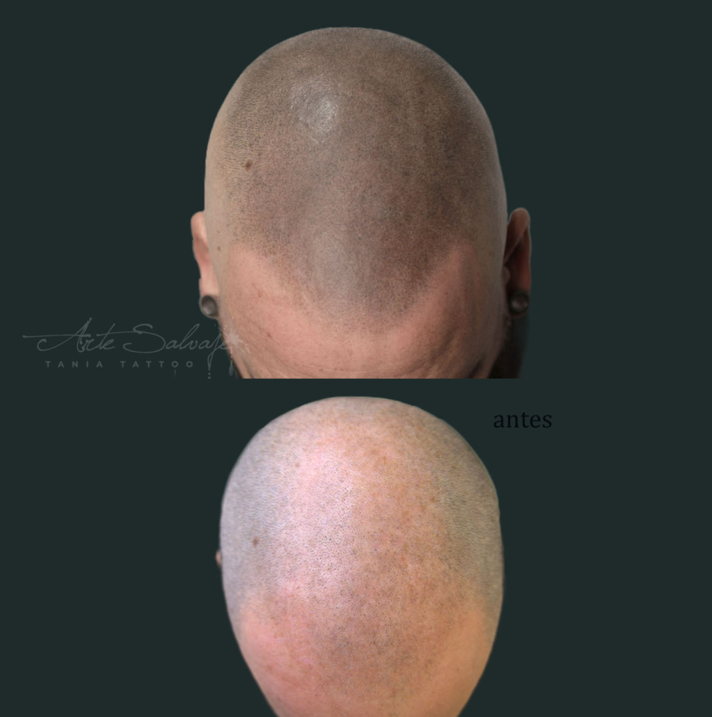 capilar en valencia tatuar pelo de micropigmentacion efecto rapado y densidad para hombre y mujer 3 (2)