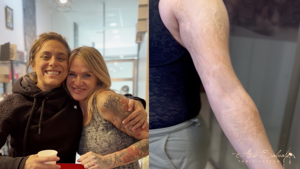 Tatuajes para tapar cicatrices