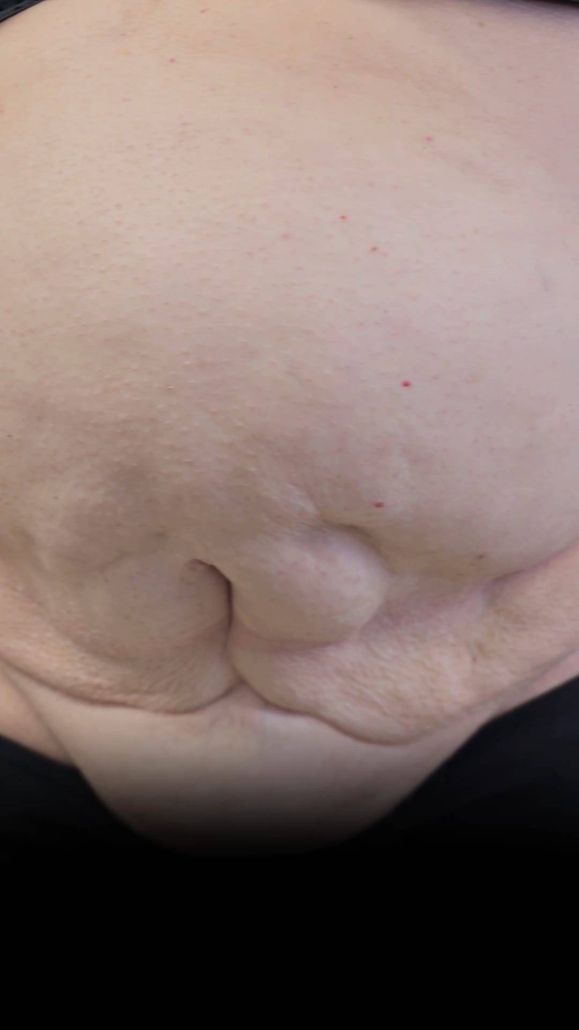 Barriga mujer historia